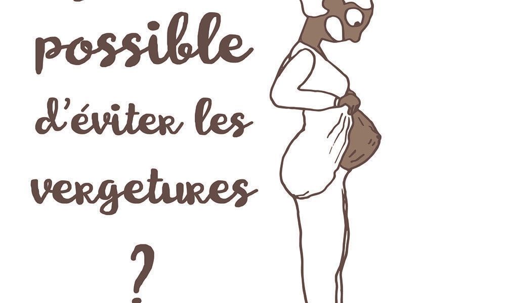 peaux noires, peaux métissées, beauté noire, grossesse, vergetures, lutter contre les vergetures